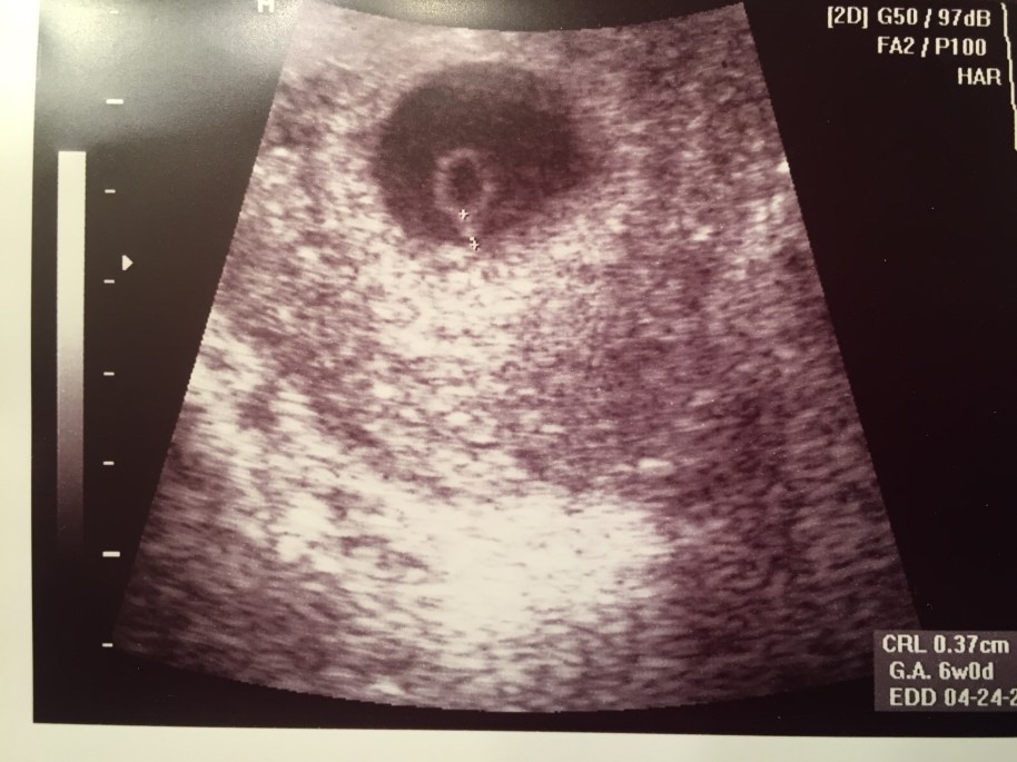 FullSizeRender 2.jpg